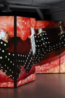 Documentation photography of the solo exhibition